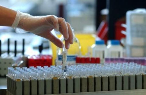 Righini: ‘Regione conferma volontà di soppressione laboratori diagnostica”