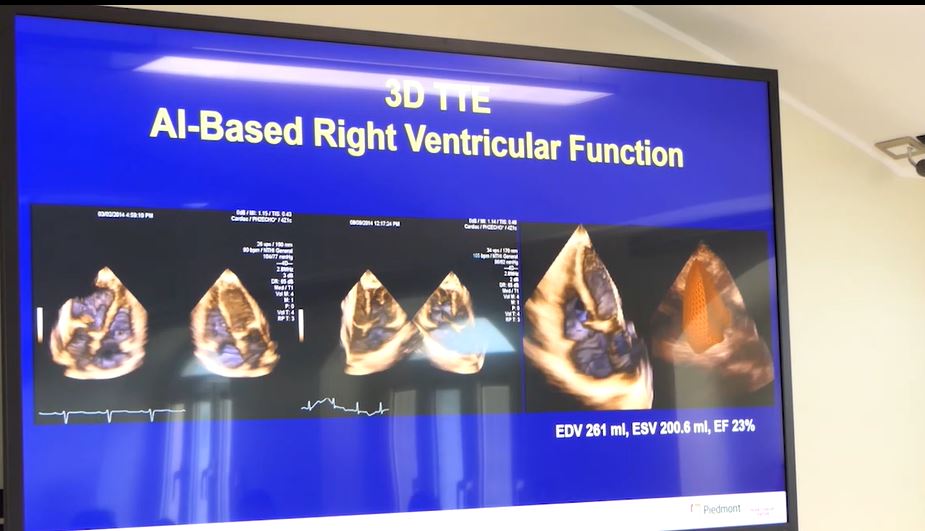 Roma: all’ospedale San Carlo de Nancy la quarta edizione del corso di ecocardiografia transesofagea 3D